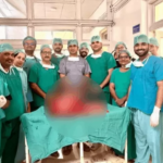 जयपुर SMS हॉस्पिटल के डॉक्टरों का मेडिकल चमत्कार: महिला के पेट से निकाली 28.6 किलो की विशाल गांठ; 3 घंटे चला ऑपरेशन, दुनिया भर में अब तक केवल 20 ऐसे केस रिपोर्ट